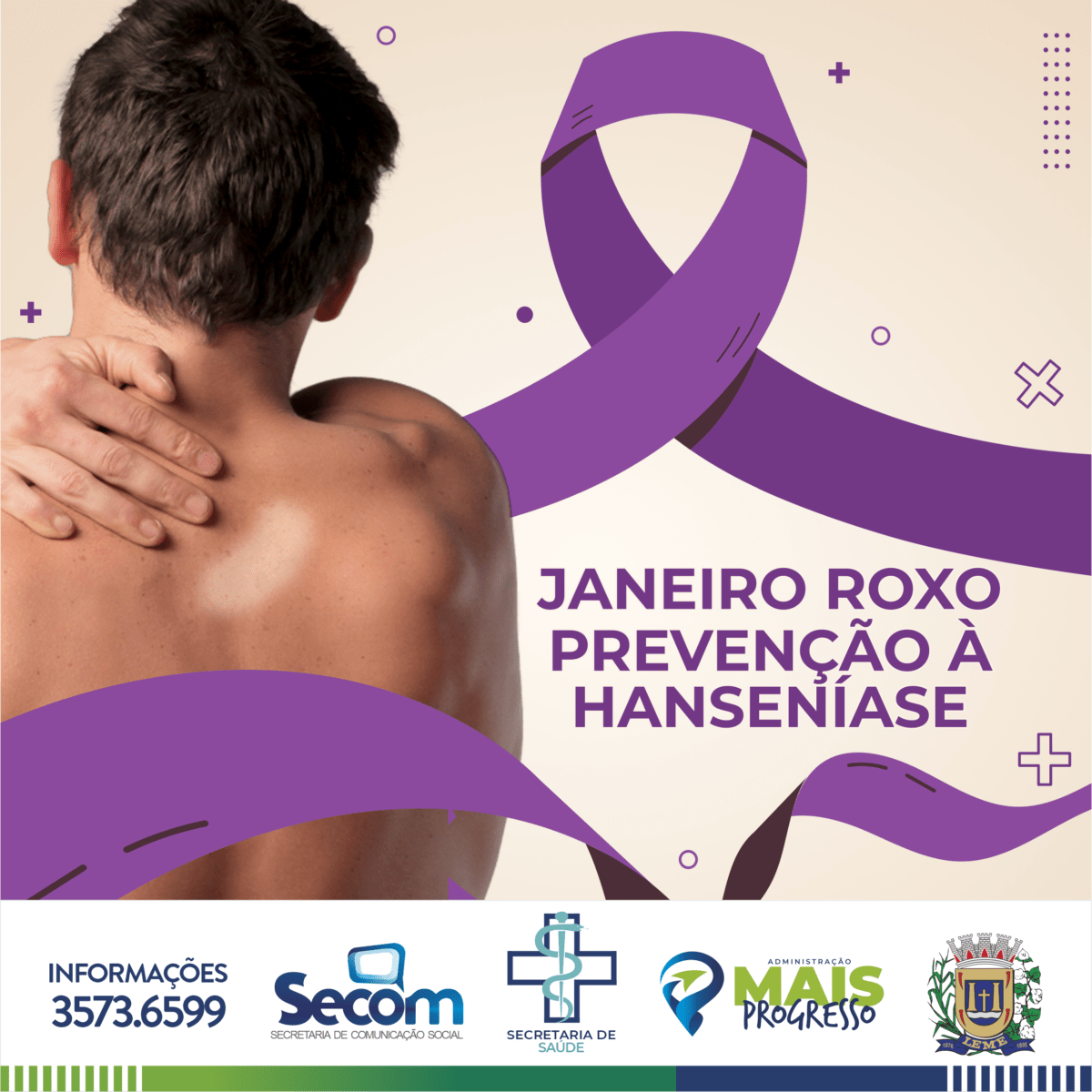 Janeiro Roxo tem diagnóstico e prevenção da Hanseníase como temas